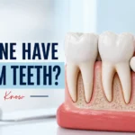 Does Everyone Have Wisdom Teeth